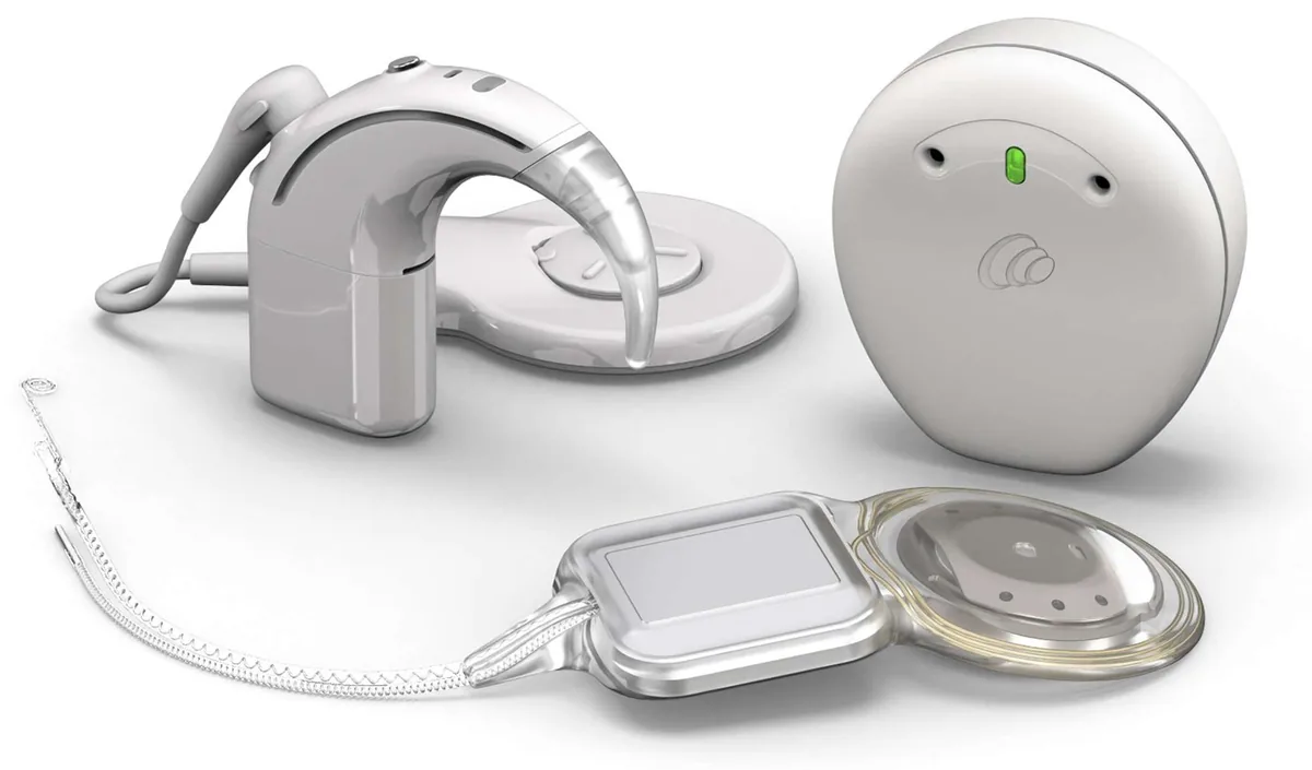 A cochlear implant system: a behind-the-ear sound processor with its coil, an off-the-ear sound processor, and the implant with its electrode array